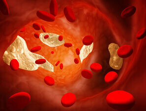 Bild zu Lipidstoffwechsel - Lipidmodifizierende Therapie-Optionen