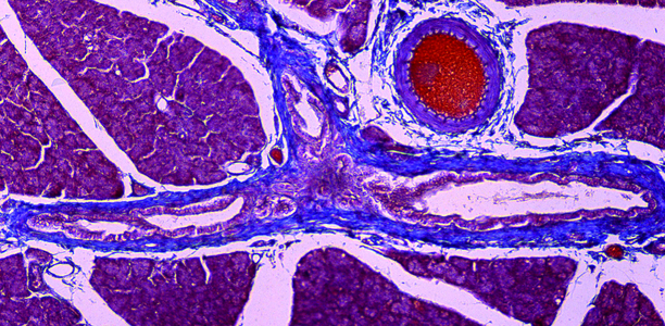 Bild zu Forschungspreis - Mikrochips mit Pankreasinseln beladen dank Menarini-Preisgeld