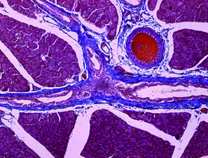 Bild zu Forschungspreis - Mikrochips mit Pankreasinseln beladen dank Menarini-Preisgeld