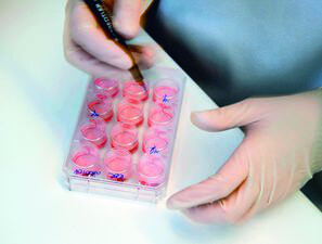 Bild zu Forschung - Stammzellen zu Beta­zellen: neue Chancen für die Zellersatztherapie