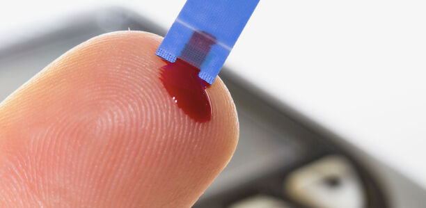 Bild zu Blutzuckermessung - Blood Glucose Measurement by Means of Glucoseoxidase-based Blood Glucose Test Strips – Clinical Relevance of Laboratory Concerns