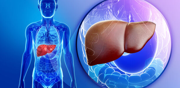 Bild zu Steatohepatitis - NAFL: Gründe für dramatische Krankheitsverläufe entdeckt