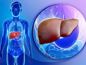 Bild zu Steatohepatitis - NAFL: Gründe für dramatische Krankheits­verläufe entdeckt