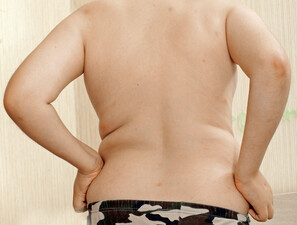 Bild zu Adipositas - Unerkannte Adipositas gefährdet Gesundheit von Jugendlichen