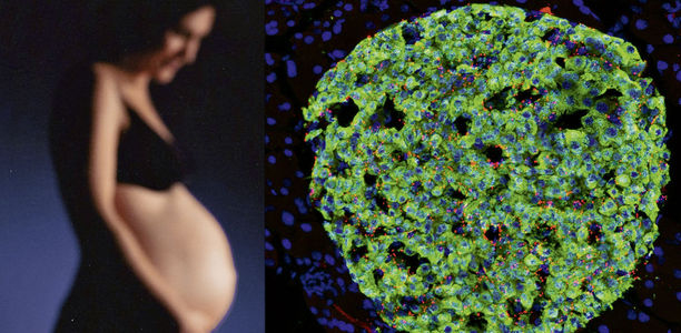 Bild zu Diabetesentstehung - Überraschende regulatorische Rolle