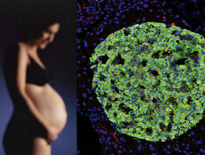 Bild zu Diabetesentstehung - Überraschende regulatorische Rolle