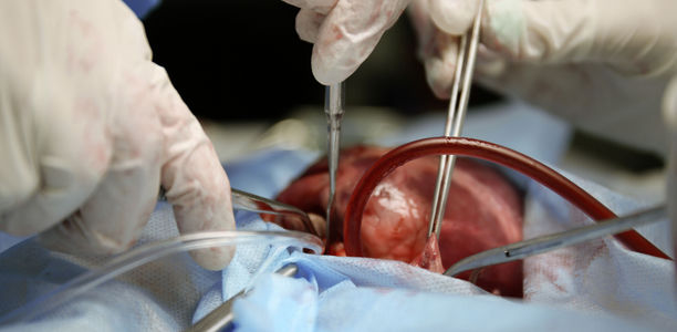 Bild zu Schwerpunkt „Diabetes und Herzerkrankungen“ - Operationsmethoden: OP-Spektrum in der Klinik