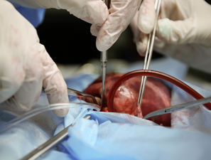 Bild zu Schwerpunkt „Diabetes und Herzerkrankungen“ - Operationsmethoden: OP-Spektrum in der Klinik