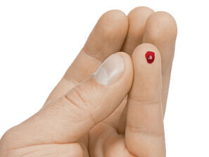 Bild zu β-Zelldysfunktion - Evaluierung eines neuen spezifischen Schnelltests