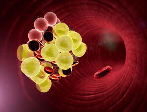 Bild zu Lipiddiagnostik - Erweiterte Lipiddiagnostik mittels NMR-Spektroskopie