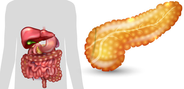 Bild zu BVKD - Transplantation von autologen Inselzellen
