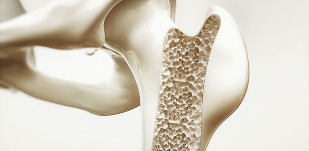 Bild zu Original article - Relationship between Blood Glucose Level, Glycated Haemoglobin, and Bone Mineral Density in Patients with Type 2 Diabetes