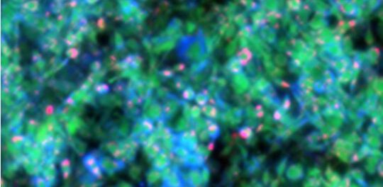 Bild zu Stoffwechselvorgänge - Neue markerfreie Bildgebungsmethode entwickelt