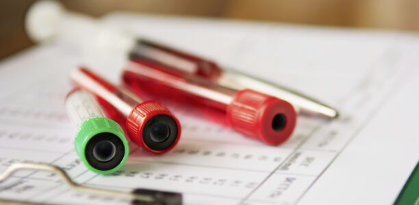 Bild zu KLD - Labordiagnostik - Auswirkungen der neuen Akzeptanzgrenzen gemäß Rili-BÄK auf die Bestehensquoten im HbA1c-Ringversuch