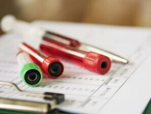 Bild zu KLD - Labordiagnostik - Auswirkungen der neuen Akzeptanzgrenzen gemäß Rili-BÄK