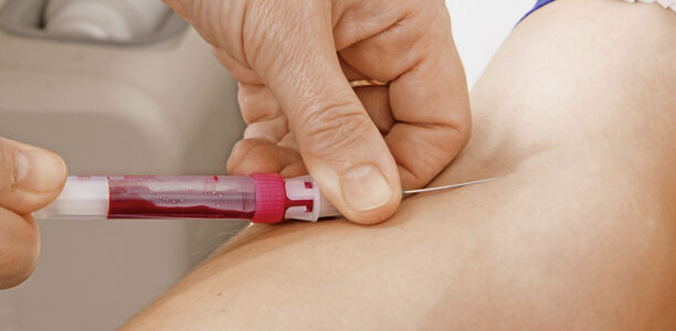 Bild zu Glukosemessung - Relative Wirksamkeit verschiedener Vorgehensweisen zur Hemmung der in-vitro-Glykolyse