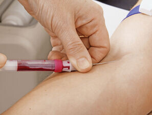 Bild zu Glukosemessung - Relative Wirksamkeit verschiedener Vorgehensweisen