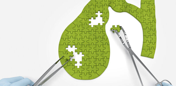 Bild zu Inkretine - Genau auf die Galle schauen