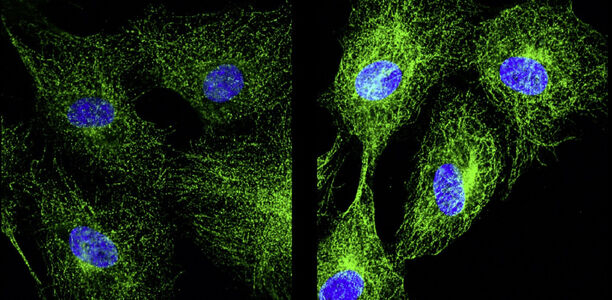 Bild zu Grundlagenforschung - Zuckerlast für Proteine