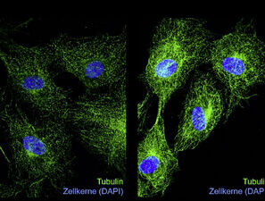 Bild zu Grundlagenforschung - Zuckerlast für Proteine
