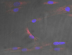 Bild zu Adipositas - Fettes Stresssignal