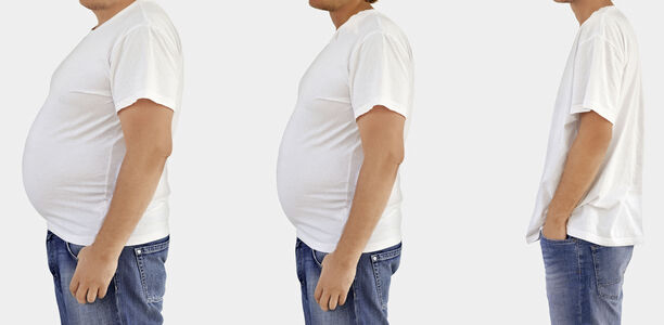 Bild zu Adipositas - Adipositas durch Neuroleptika und Antihistaminika: Ein Risiko für Herz, Kreislauf und die Entstehung von Diabetes