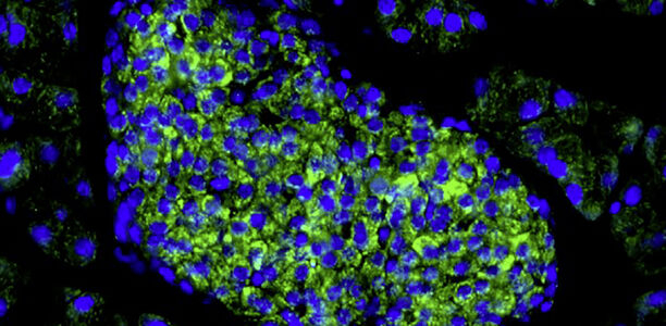 Bild zu Grundlagenforschung - Wie die Betazelle flüstert