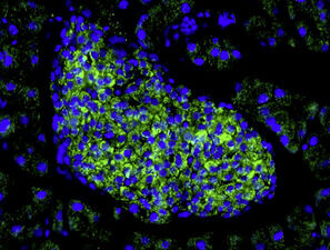 Bild zu Grundlagenforschung - Wie die Betazelle flüstert