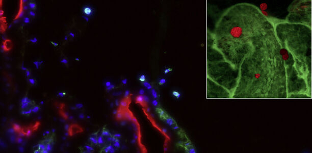 Bild zu Ophthalmologie - Prädiabetische Immunattacke