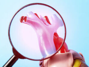 Bild zu Empfehlungen zur Diagnose und Therapie der HFpEF - Update 2023 der ESC-Leitlinien zur Herzinsuffizienz