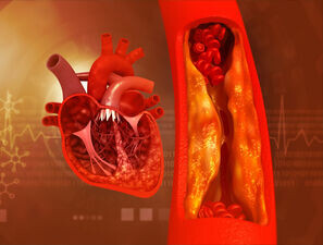 Bild zu ANZEIGE - Atherosklerose und Gefäßschutz bei Typ-2-Diabetes