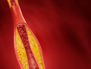 Bild zu Schwerpunkt Blutgerinnungssysteme - Prophylaxe und Therapie