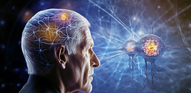 Bild zu Schwerpunkt "Demenz" - Kommentar: Aus dem Blickwinkel der Kardioanästhesiologie 