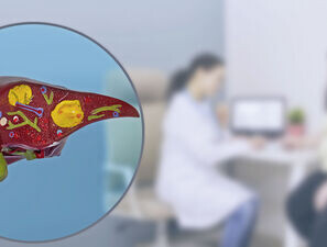 Bild zu Schwerpunkt Adipositas - Heterogenität bei Fettlebererkrankung