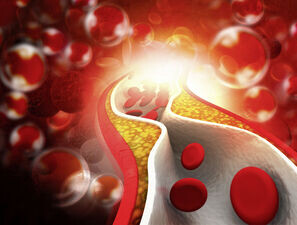 Bild zu "Vaskuläre Komplikationen" - pAVK bei Diabetes: Diagnostik und Therapie