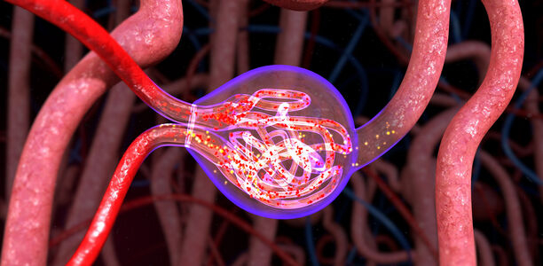 Bild zu "Vaskuläre Komplikationen" - Diabetes und Niere: Diagnose und Therapie