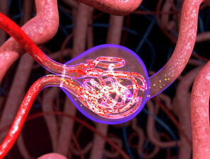 Bild zu "Vaskuläre Komplikationen" - Diabetes und Niere: Diagnose und Therapie