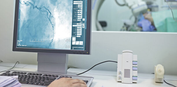 Bild zu "Vaskuläre Komplikationen" - Weniger ist mehr – auch in der Kardio-Diagnostik