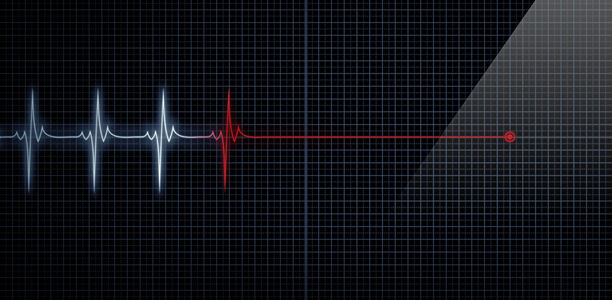 Bild zu "Vaskuläre Komplikationen" - Sterbefälle wegen Herzkrankheiten steigen  