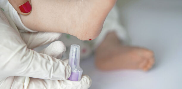 Bild zu VDBD - Früherkennung von Typ-1-Diabetes essenziell