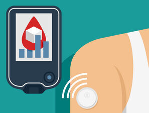 Bild zu diatec - eCGM - "Neuer" Ansatz zur Bewertung von CGM-Systemen