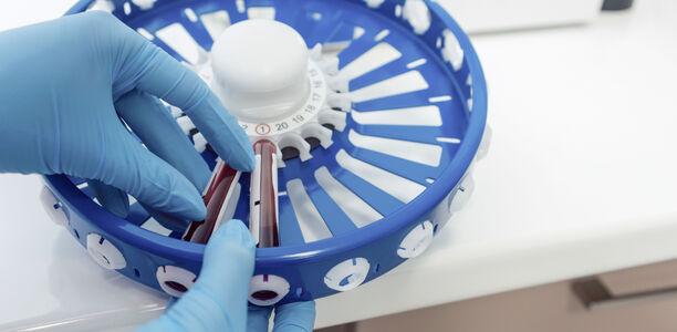 Bild zu Interview - Glukosemessung im Fokus 