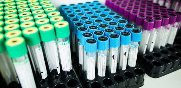 Bild zu Farbcode der Teströhrchen: - Der deutsche Sonderweg führt zu Konfusion