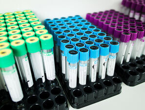 Bild zu Farbcode der Teströhrchen: - Der deutsche Sonderweg führt zu Konfusion