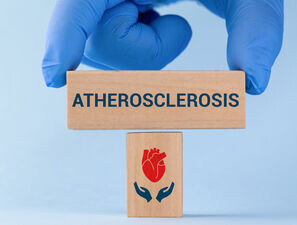 Bild zu Koronare Herzkrankheit - Update Diagnostik und Therapie der KHK