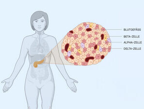 Bild zu Typ‑2‑Diabetes - Erklärbare KI zeigt Veränderungen im Pankreasgewebe