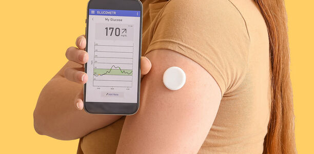 Bild zu Neue Studie - Grenzen der Vergleichbarkeit von Messdaten moderner Glukosemesssysteme