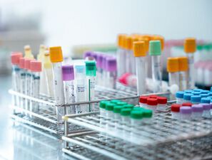 Bild zu Neben Insulin: - Rolle der hepatischen Glukagonresistenz bei Typ-2-Diabetes