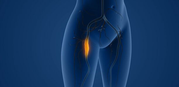 Bild zu Blickpunkt - Fokus periphere arterielle Verschlusskrankheit
