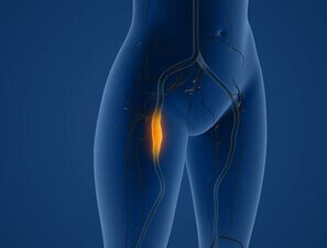 Bild zu Blickpunkt - Fokus periphere arterielle Verschlusskrankheit